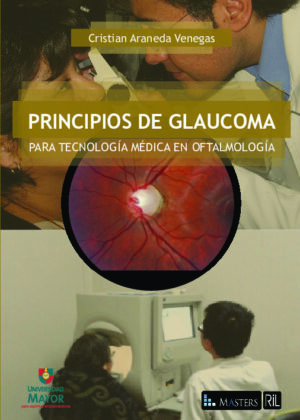 Principios de glaucoma para tecnología médica en oftalmología