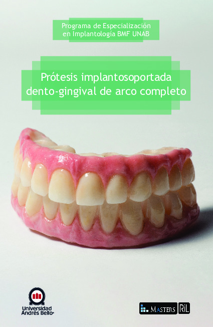 Prótesis implantosoportada dento-gingival de arco completo